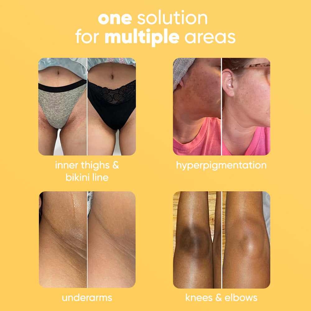 the lemon turmeric & kojic acid brightening soap