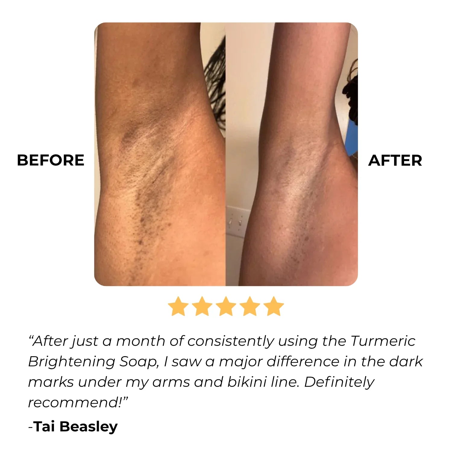 the lemon turmeric & kojic acid brightening soap